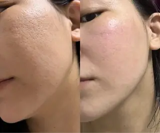 マツエク・マツパ aliaハイフ&水光ジェットサロン所属・aliaハーブ水光店 エステティシャン募集のエステ・リラクイメージ