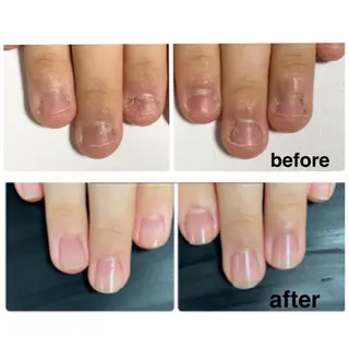 ネイル センター南 eclatのネイルデザイン