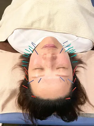 美容鍼　蒼月-aotsuki-所属・美容鍼「蒼月」 -アオツキ-のエステ・リラクイメージ