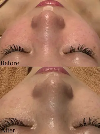 beautysalon LIMOA所属・松本 愛絵理のエステ・リラクイメージ