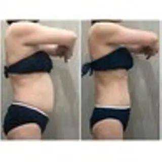 エステティックサロン ベルネのエステ・リラクイメージ