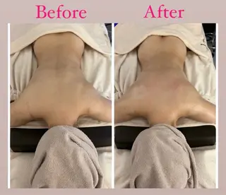 ブライダルエステ&肌管理OGUMO所属・肌管理 OGUMOのエステ・リラクイメージ