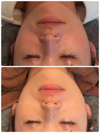 FLEURフェイシャ ル🫧ハーブ🌿小顔のエステ・リラクイメージ