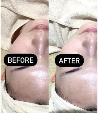 アイアンド ネイルデイのエステ・リラクイメージ