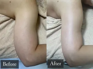 脱毛専門サロン BELFINE恵比寿のエステ・リラクイメージ