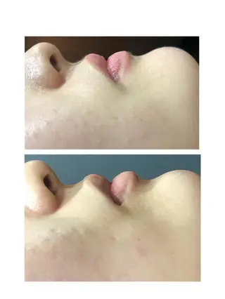 ✨シェービング 美肌ケア✨菊地の眉毛・アイブロウイメージ