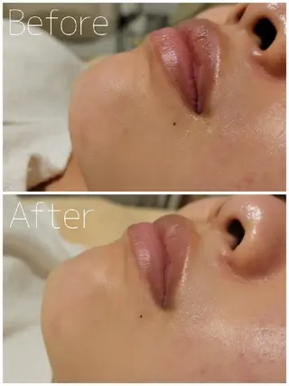 毛穴/肌管理/痩身/ ボディケア/satoのエステ・リラクイメージ