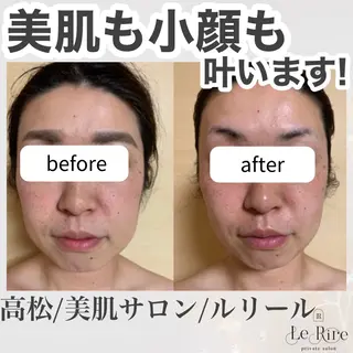 プライベートサロンLe Rire【ルリール】所属・美肌•小顔サロン ルリールのエステ・リラクイメージ