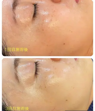 leolo武蔵浦和 肌質改善＆脱毛のエステ・リラクイメージ