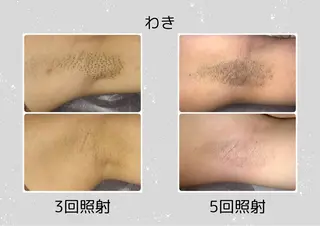 Laule'a ラウレアのエステ・リラクイメージ