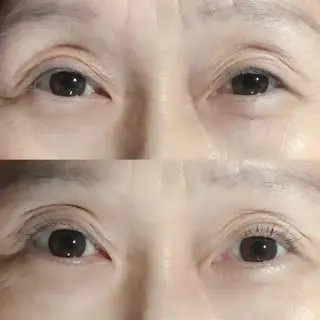 マツエク・マツパ まつげ、毛穴 TREEのエステ・リラクイメージ