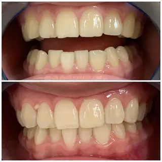 藤本 真心のネイルデザイン