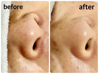 安眠ヘッドスパ美整体 🌿白金/目黒/鈴木のエステ・リラクイメージ