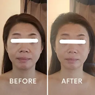 鍼灸サロンmiyabi所属・美容鍼×エステ　鍼灸 サロンmiyabiのエステ・リラクイメージ