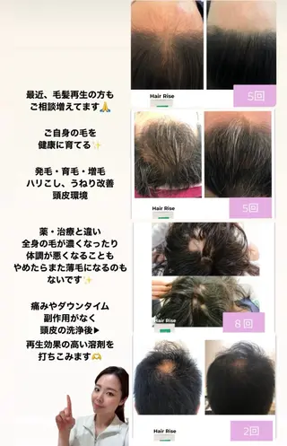 【福岡市西区 エステ】 GRANVIR(グランヴィール)所属・GRANVIR グランヴィールのエステ・リラクイメージ