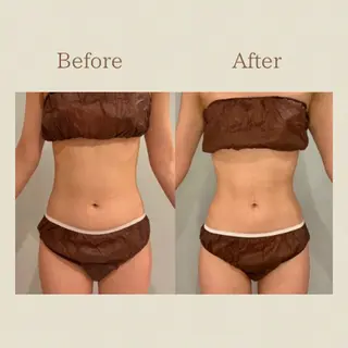 お腹痩せエステ Flat BELLY 恵比寿所属・【腸もみ/冷却痩身】 お腹エステ/恵比寿のエステ・リラクイメージ