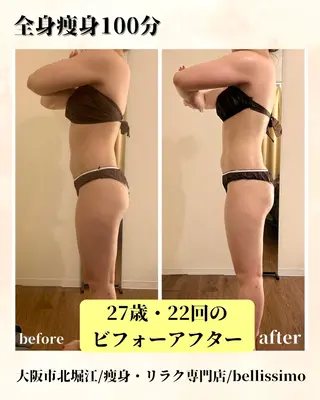 bellissimo 【ベリッシモ】所属・ちひろ　痩身/ハーブ bellissimoのエステ・リラクイメージ