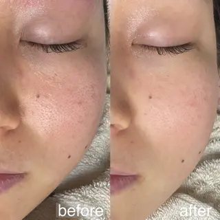 アイブロウ&フェイシャルサロンa‘lm所属・WAX脱毛/肌質改善 眉毛とお肌のサロンのエステ・リラクイメージ