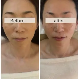 本格小顔コルギサロン ミピマムマールのエステ・リラクイメージ