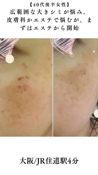 大阪大東市 / 体質・肌質改善サロン アンシャンテ所属・体質・肌質改善サロン アンシャンテのエステ・リラクイメージ