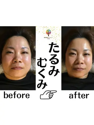 美容整体•小顔矯正CREST所属・美容整体.小顔矯正 CREST佐藤大雅のエステ・リラクイメージ