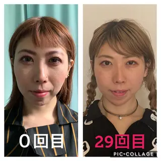 インタークロス所属・小顔矯正専門TIAM インタークロス池袋店のエステ・リラクイメージ