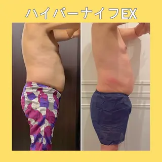 赤澤/本気痩せ・脱毛 ・ノーファンデ肌のその他イメージ