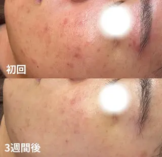 BELLIS HUIT所属・ハーブピーリング那覇 BELLISHUITのエステ・リラクイメージ