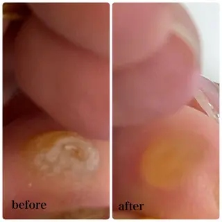 𝐑𝐢𝐞𝐯𝐞所属・HIROTA 𝐑𝐀𝐍のエステ・リラクイメージ