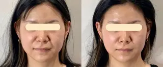 マツエク・マツパ 愛維美水光美肌専門店所属・愛維美水光美肌専門店 メンズレディースokのエステ・リラクイメージ