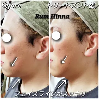 Rum Hinna ラムヒンナーのその他イメージ