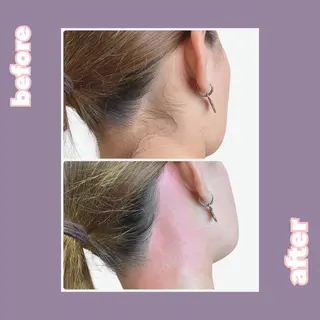 【痩身・脱毛サロン】 REBISKIN🌱のエステ・リラクイメージ