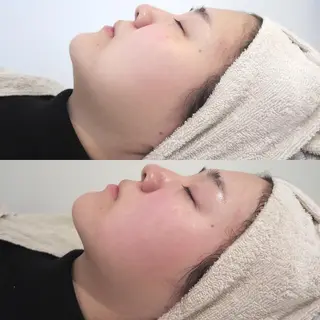 CLEAD 赤坂見附店のエステ・リラクイメージ