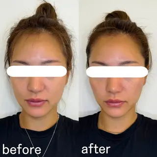 小顔矯正&美容整体 整え屋REDオーナーのエステ・リラクイメージ