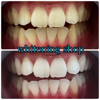 ホワイトニング ショップ千葉店のその他イメージ