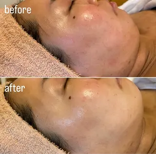 Re Amply Minamiのエステ・リラクイメージ