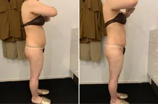 VILUZT スタッフのエステ・リラクイメージ