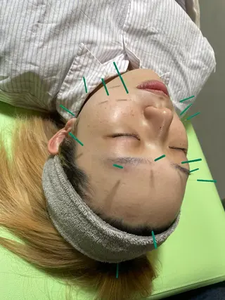 蓮花鍼灸整骨院所属・蓮花鍼灸 整骨院のその他イメージ