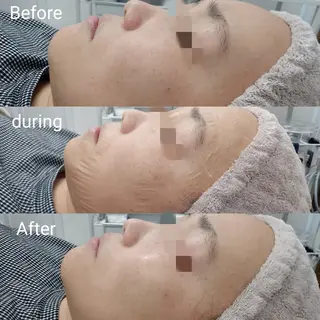 肌質改善Beauty salon Renのエステ・リラクイメージ