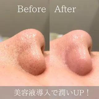 # fu♡のエステ・リラクイメージ