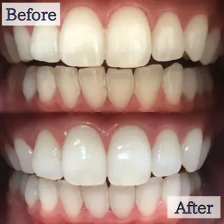 LBSホワイトニング 新宿店💝店長熊倉のエステ・リラクイメージ