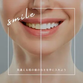 メンズ ホワイトニング ショップ本八幡店のエステ・リラクイメージ