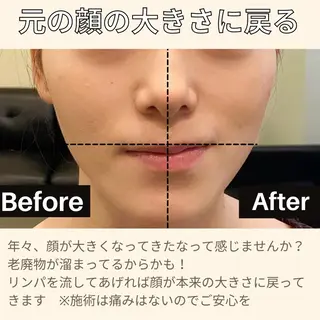 肩首こり×痩身×浄化 🌿リンパエステのエステ・リラクイメージ