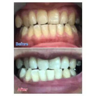 M渋谷店所属・Ｍ渋谷 ホワイトニングのその他イメージ