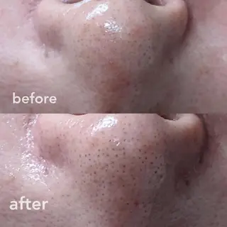 南流山 ネイルサロン グランツィア のネイルデザイン