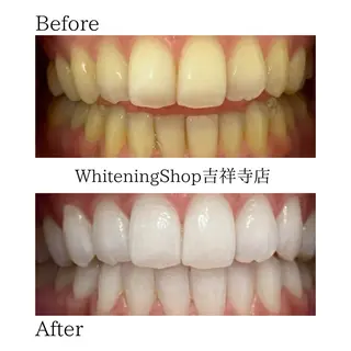 ホワイトニングショッ 吉祥寺2号店のその他イメージ