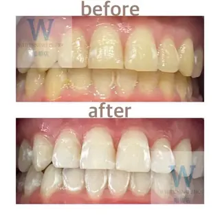 ホワイトニング ショップ船橋店🦷のエステ・リラクイメージ