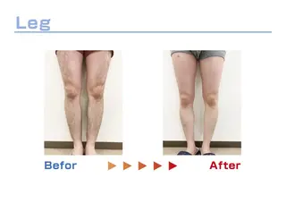 セルフ脱毛/美尻イス キングスサロン熊本のエステ・リラクイメージ