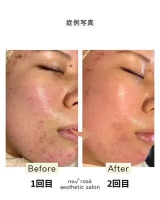 ノールート ロゼのエステ・リラクイメージ