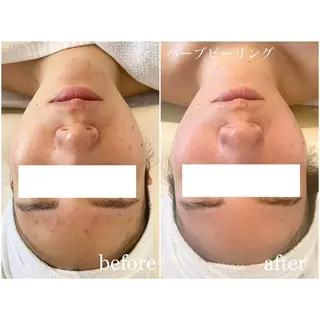 I'm -ｲﾑ-所属・肌質改善／ブライダル I'm.-イム-のエステ・リラクイメージ